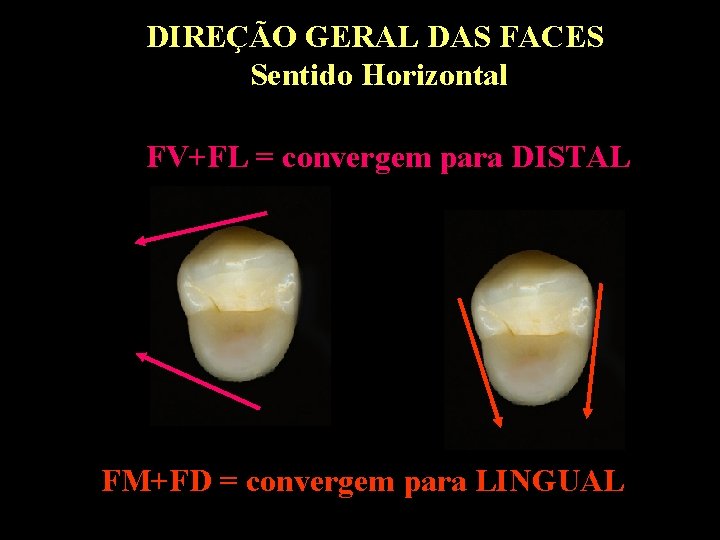 DIREÇÃO GERAL DAS FACES Sentido Horizontal FV+FL = convergem para DISTAL FM+FD = convergem