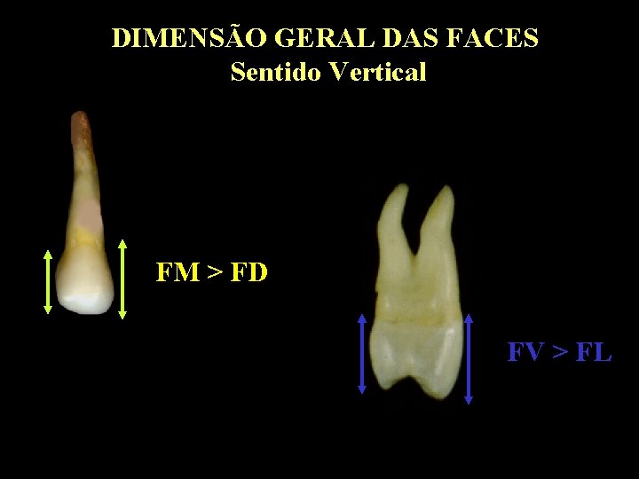 DIMENSÃO GERAL DAS FACES Sentido Vertical FM > FD FV > FL 