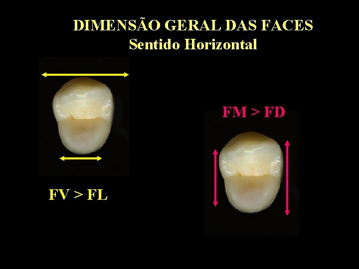 DIMENSÃO GERAL DAS FACES Sentido Horizontal FM > FD FV > FL 