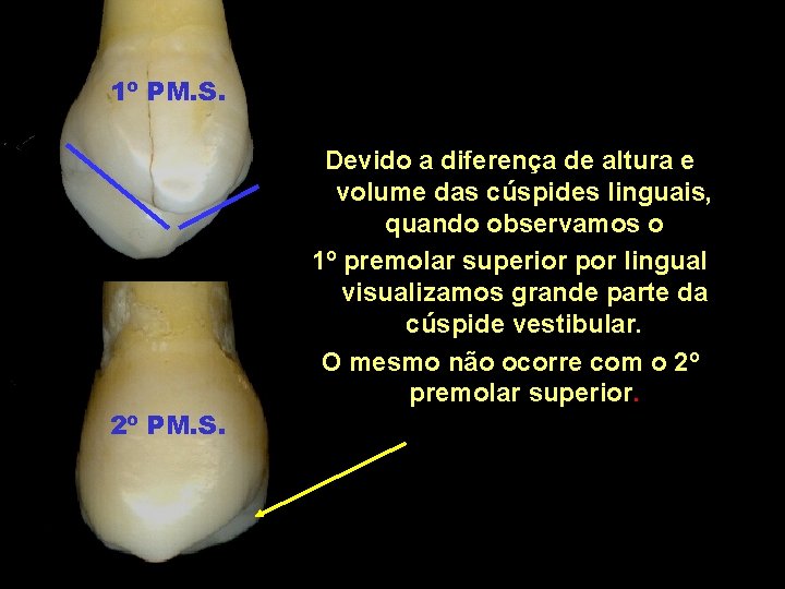 1º PM. S. 2º PM. S. Devido a diferença de altura e volume das