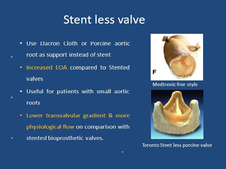 Pericardial valve: • Made from Bovine pericardium mainly but from Porcine or Equine also.