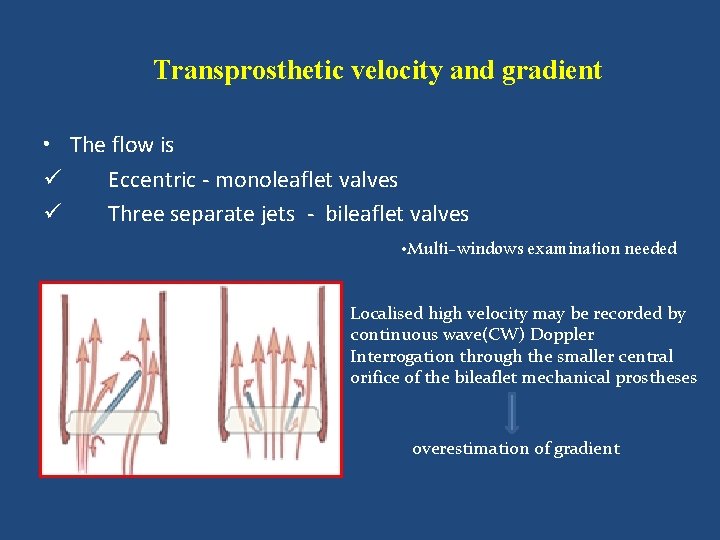 Transprosthetic velocity and gradient • The flow is ü Eccentric - monoleaflet valves ü