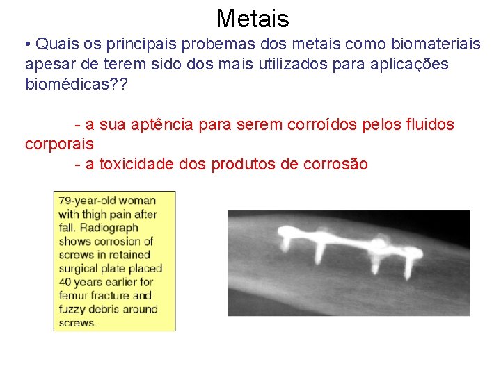 Metais • Quais os principais probemas dos metais como biomateriais apesar de terem sido