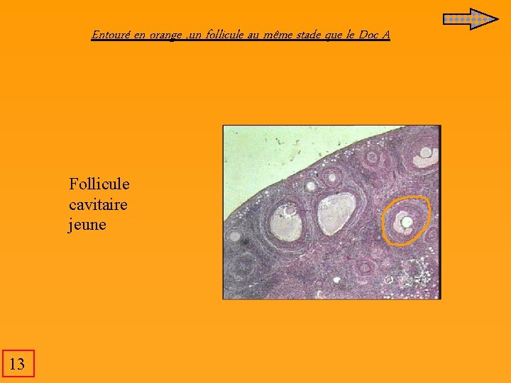Entouré en orange , un follicule au même stade que le Doc A Follicule Entouré en orange , un follicule au même stade que le Doc A Follicule