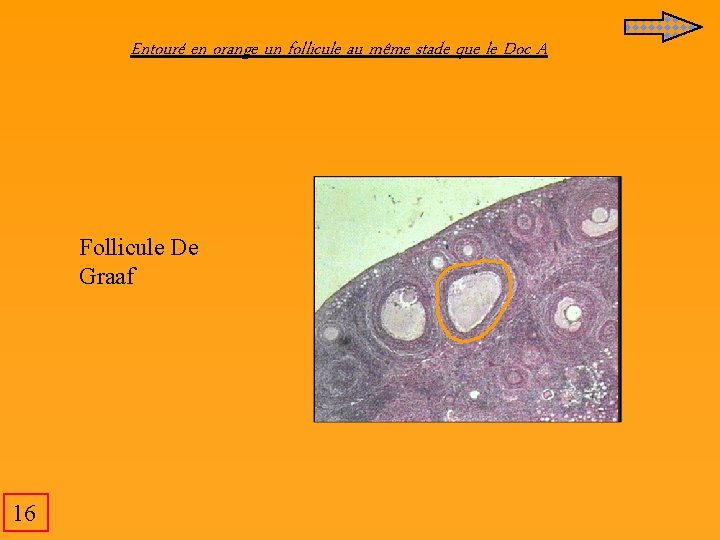 Entouré en orange un follicule au même stade que le Doc A Follicule De Entouré en orange un follicule au même stade que le Doc A Follicule De