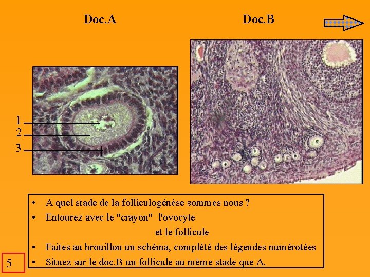 Doc. A Doc. B 1 2 3 5 • A quel stade de la