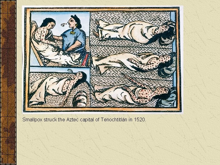 Smallpox struck the Aztec capital of Tenochtitlán in 1520. 