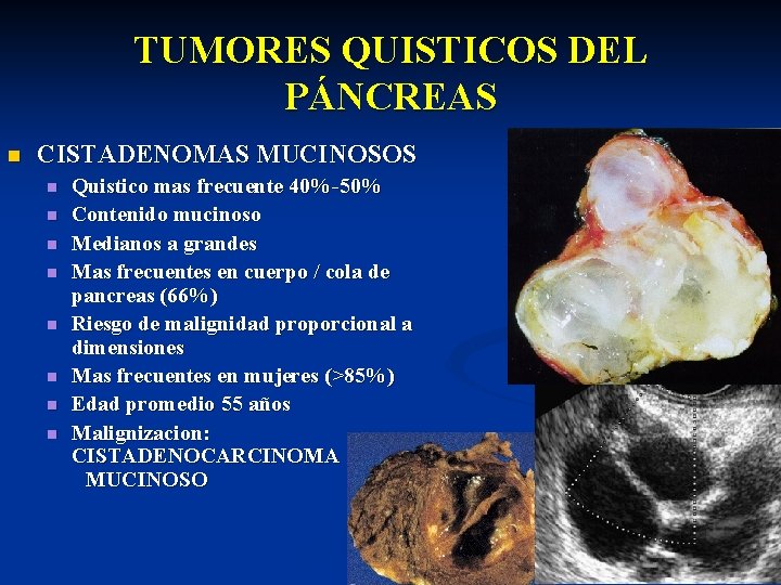 TUMORES QUISTICOS DEL PÁNCREAS n CISTADENOMAS MUCINOSOS n n n n Quistico mas frecuente