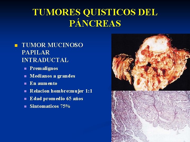 TUMORES QUISTICOS DEL PÁNCREAS n TUMOR MUCINOSO PAPILAR INTRADUCTAL n n n Premalignos Medianos