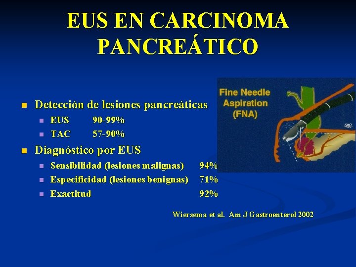 EUS EN CARCINOMA PANCREÁTICO n Detección de lesiones pancreáticas n n n EUS TAC
