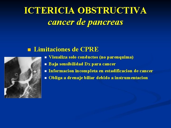 ICTERICIA OBSTRUCTIVA cancer de pancreas n Limitaciones de CPRE n n Visualiza solo conductos