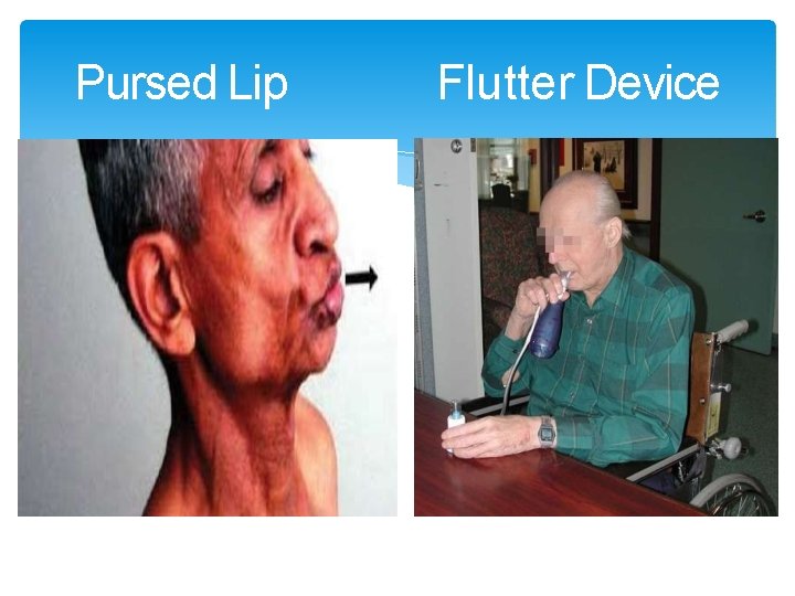 Pursed Lip Flutter Device 