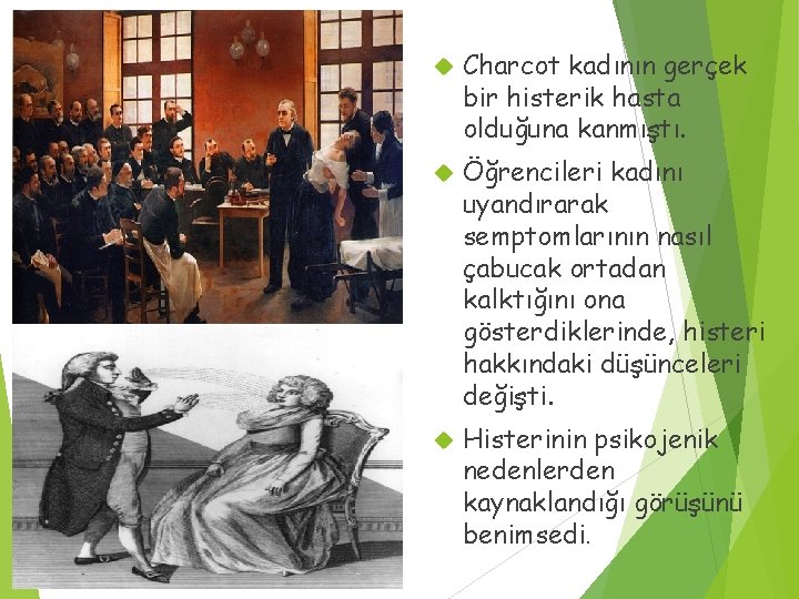  Charcot kadının gerçek bir histerik hasta olduğuna kanmıştı. Öğrencileri kadını uyandırarak semptomlarının nasıl