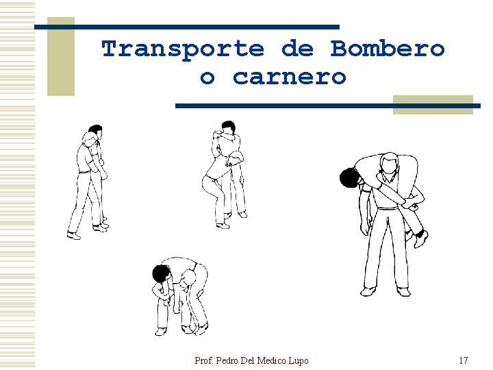 Transporte de Bombero o carnero Prof. Pedro Del Medico Lupo 17 