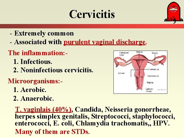 Cervicitis - Extremely common - Associated with purulent vaginal discharge. The inflammation: 1. Infectious.