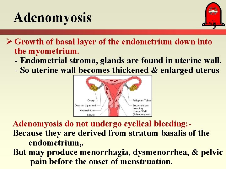 Adenomyosis Ø Growth of basal layer of the endometrium down into the myometrium. -