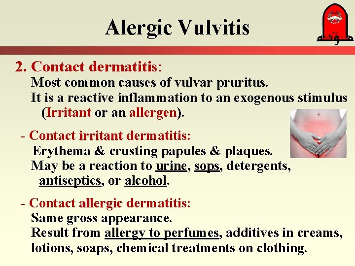 Alergic Vulvitis 2. Contact dermatitis: Most common causes of vulvar pruritus. It is a