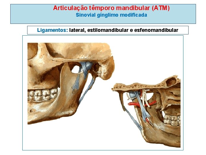 Articulação têmporo mandibular (ATM) Sinovial gínglimo modificada Ligamentos: lateral, estilomandibular e esfenomandibular 