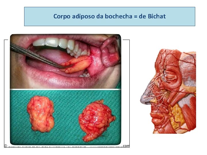 Corpo adiposo da bochecha = de Bichat 