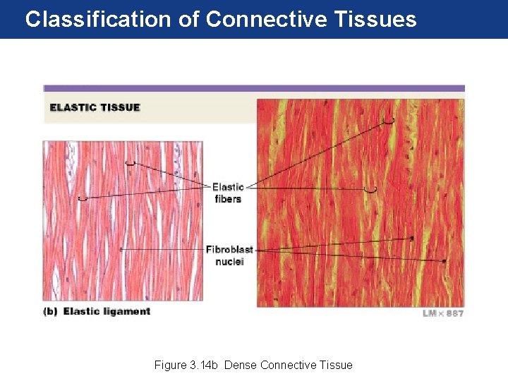 Classification of Connective Tissues Figure 3. 14 b Dense Connective Tissue 