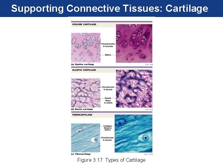 Supporting Connective Tissues: Cartilage Figure 3. 17 Types of Cartilage 