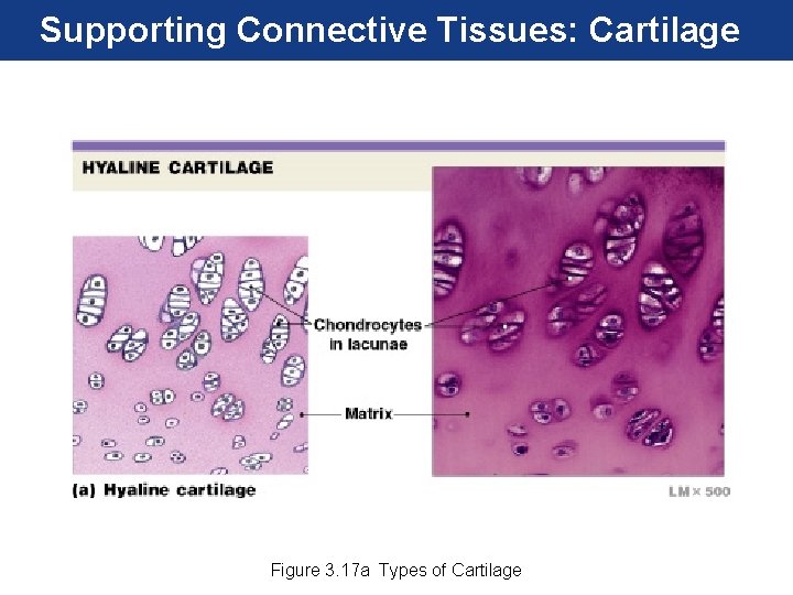 Supporting Connective Tissues: Cartilage Figure 3. 17 a Types of Cartilage 