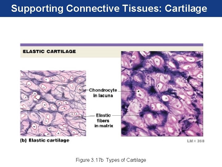 Supporting Connective Tissues: Cartilage Figure 3. 17 b Types of Cartilage 