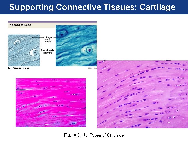 Supporting Connective Tissues: Cartilage Figure 3. 17 c Types of Cartilage 