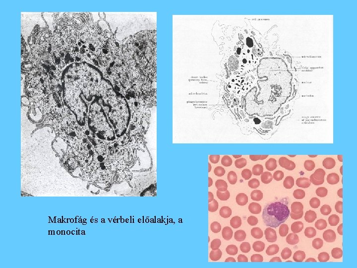 Makrofág és a vérbeli előalakja, a monocita 