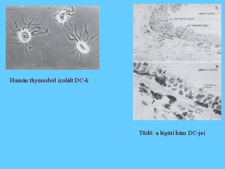 Humán thymusból izolált DC-k Tüdő: a légúti hám DC-jei 