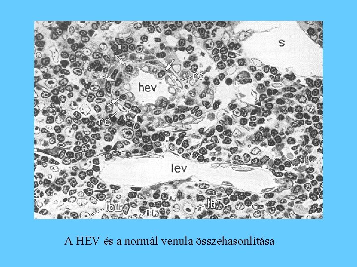 A HEV és a normál venula összehasonlítása 