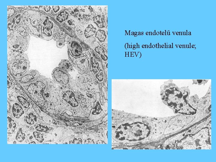 Magas endotelű venula (high endothelial venule; HEV) 