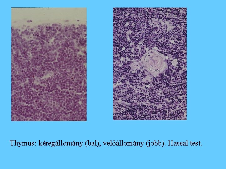 Thymus: kéregállomány (bal), velőállomány (jobb). Hassal test. 