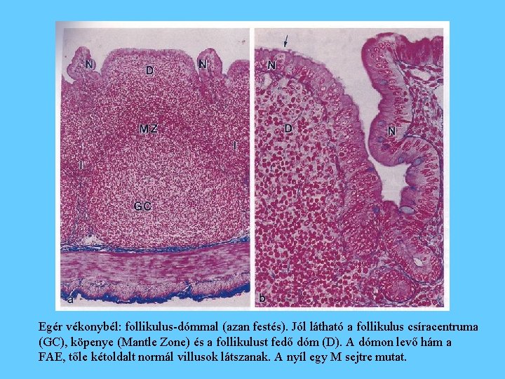 Egér vékonybél: follikulus-dómmal (azan festés). Jól látható a follikulus csíracentruma (GC), köpenye (Mantle Zone)