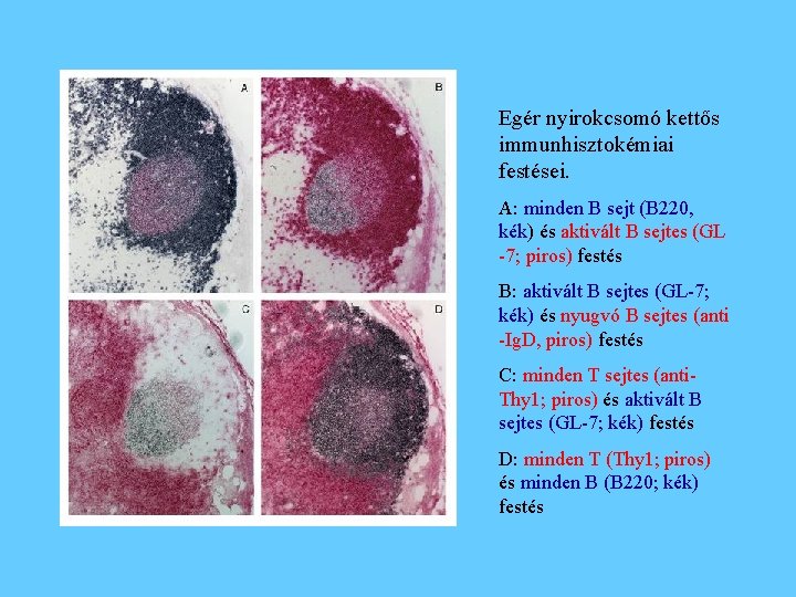 Egér nyirokcsomó kettős immunhisztokémiai festései. A: minden B sejt (B 220, kék) és aktivált