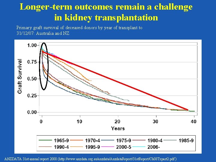 Longer-term outcomes remain a challenge in kidney transplantation Primary graft survival of deceased donors