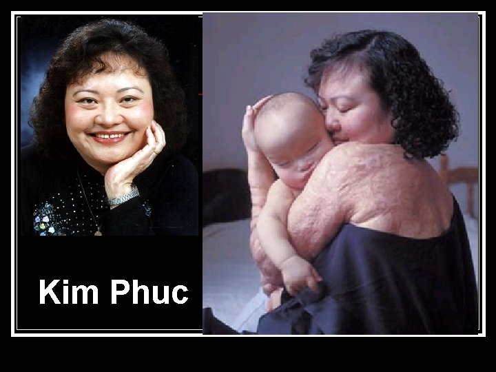 Kim Phuc 