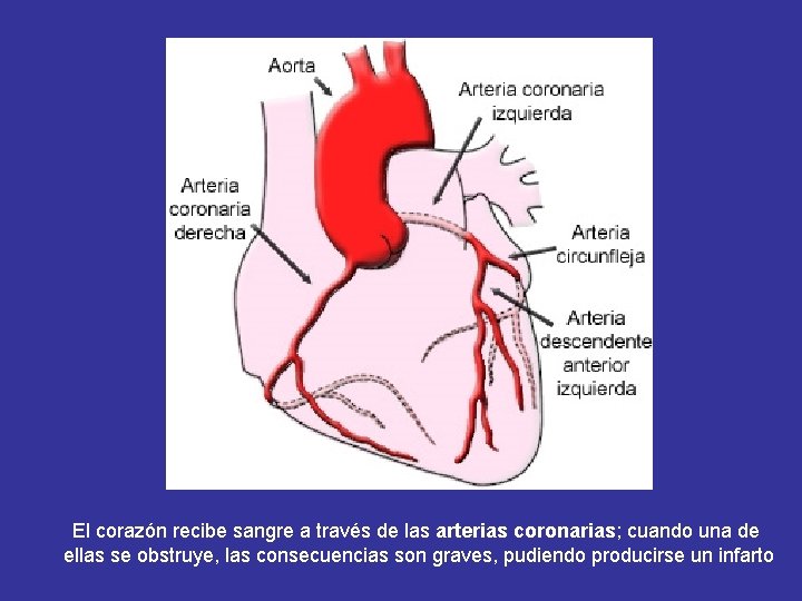 El corazón recibe sangre a través de las arterias coronarias; cuando una de ellas