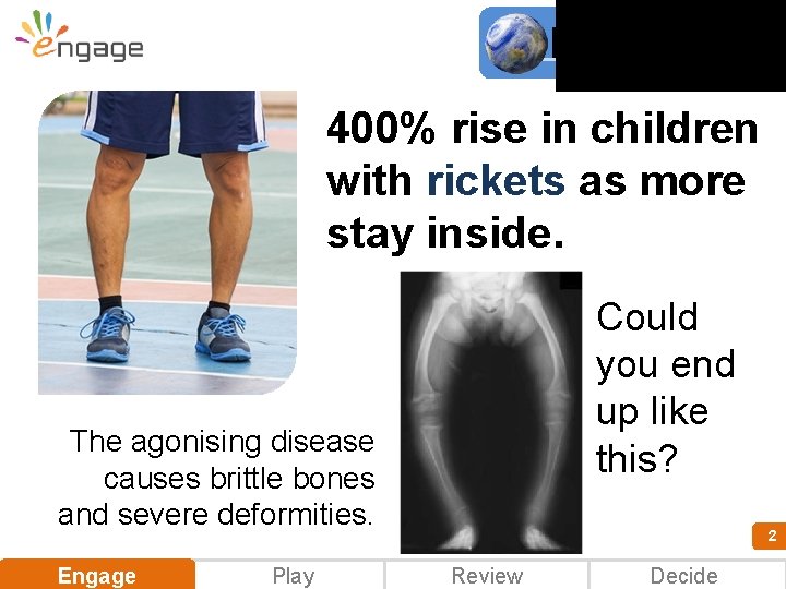 nline news 400% rise in children with rickets as more stay inside. Could you