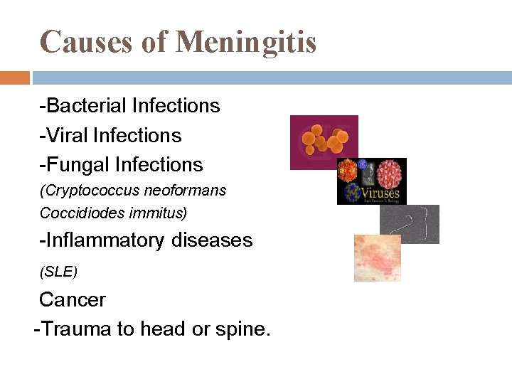 Causes of Meningitis -Bacterial Infections -Viral Infections -Fungal Infections (Cryptococcus neoformans Coccidiodes immitus) -Inflammatory Causes of Meningitis -Bacterial Infections -Viral Infections -Fungal Infections (Cryptococcus neoformans Coccidiodes immitus) -Inflammatory