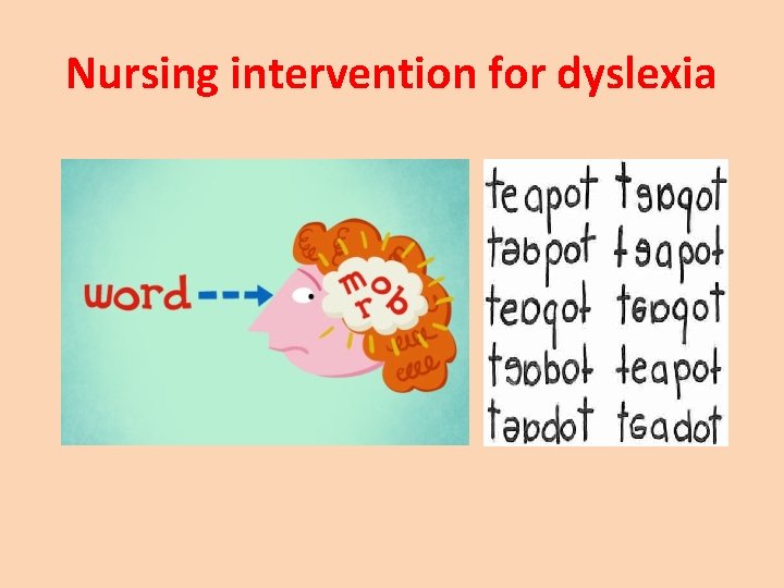 Nursing intervention for dyslexia 