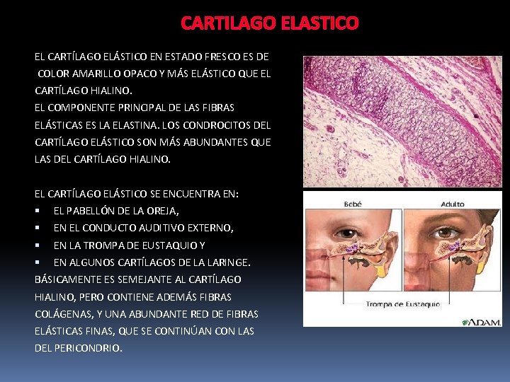 CARTILAGO ELASTICO EL CARTÍLAGO ELÁSTICO EN ESTADO FRESCO ES DE COLOR AMARILLO OPACO Y