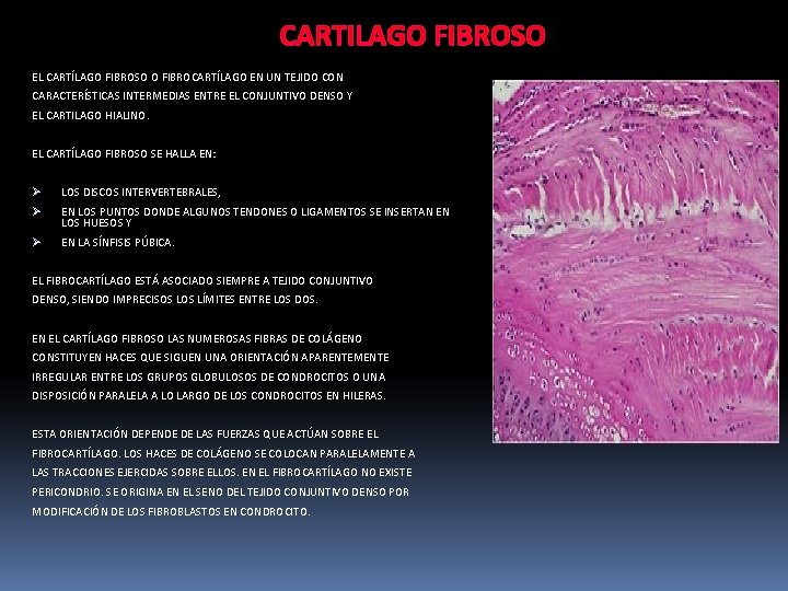 CARTILAGO FIBROSO EL CARTÍLAGO FIBROSO O FIBROCARTÍLAGO EN UN TEJIDO CON CARACTERÍSTICAS INTERMEDIAS ENTRE