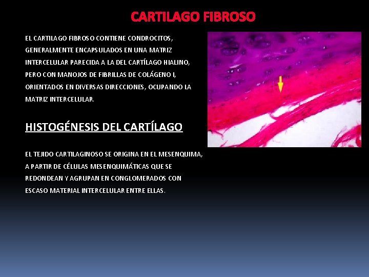 CARTILAGO FIBROSO EL CARTILAGO FIBROSO CONTIENE CONDROCITOS, GENERALMENTE ENCAPSULADOS EN UNA MATRIZ INTERCELULAR PARECIDA
