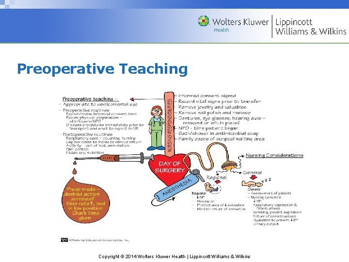 Preoperative Teaching Copyright © 2014 Wolters Kluwer Health | Lippincott Williams & Wilkins Preoperative Teaching Copyright © 2014 Wolters Kluwer Health | Lippincott Williams & Wilkins