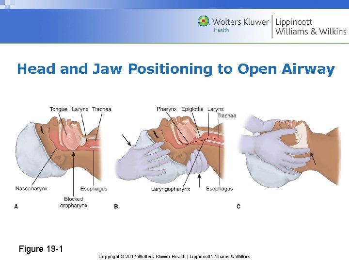 Head and Jaw Positioning to Open Airway Figure 19 -1 Copyright © 2014 Wolters Head and Jaw Positioning to Open Airway Figure 19 -1 Copyright © 2014 Wolters