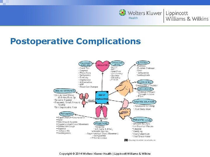 Postoperative Complications Copyright © 2014 Wolters Kluwer Health | Lippincott Williams & Wilkins Postoperative Complications Copyright © 2014 Wolters Kluwer Health | Lippincott Williams & Wilkins