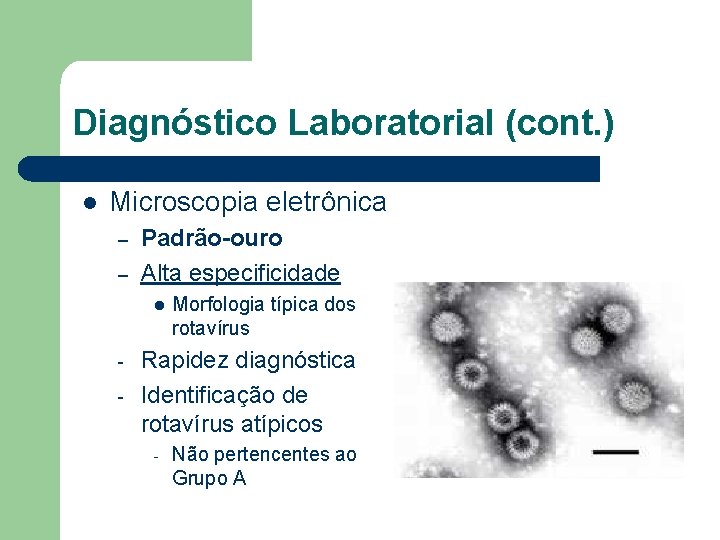 Diagnóstico Laboratorial (cont. ) l Microscopia eletrônica – – Padrão-ouro Alta especificidade l -