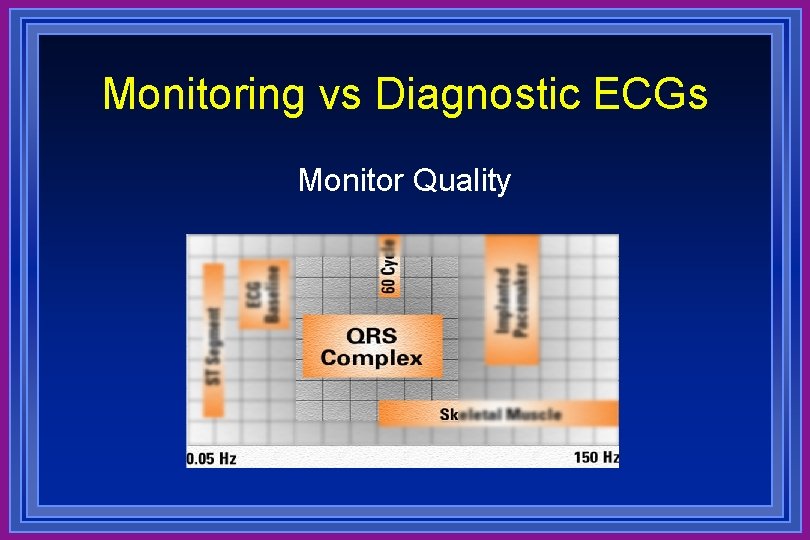 Monitoring vs Diagnostic ECGs Monitor Quality 