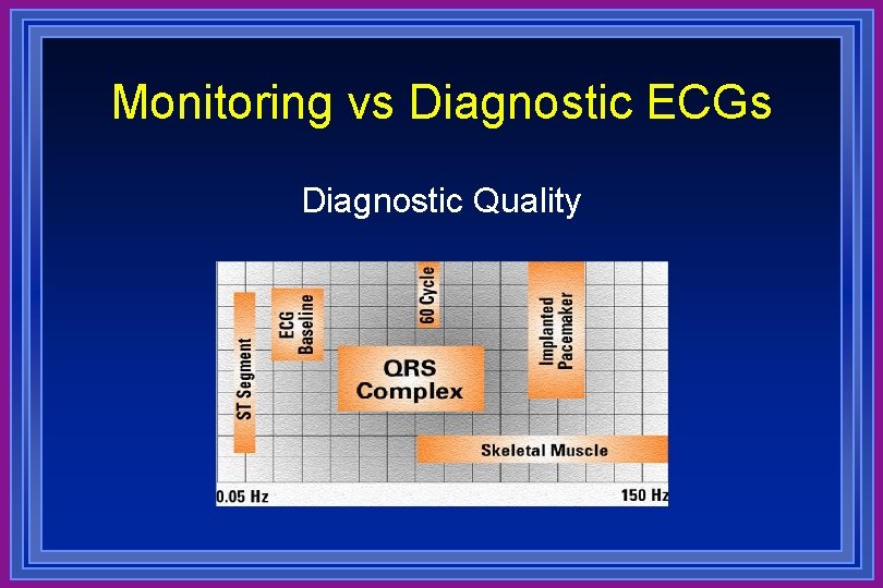 Monitoring vs Diagnostic ECGs Diagnostic Quality 